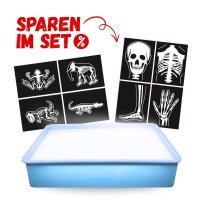 Leuchtbox mit R&ouml;ntgenbildern Sparset